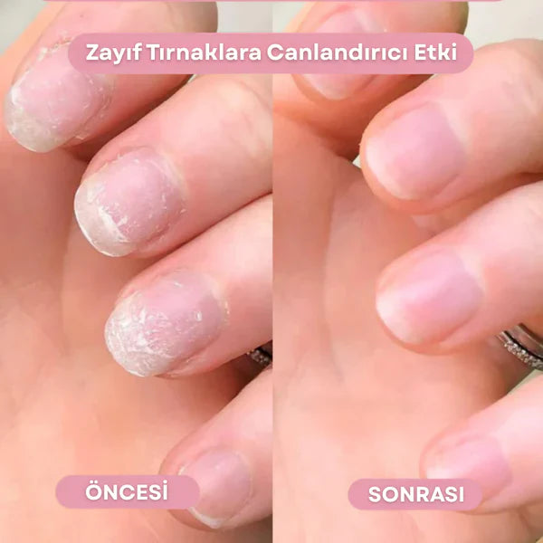 1Alana 1 Bedava! Tırnak Serumu